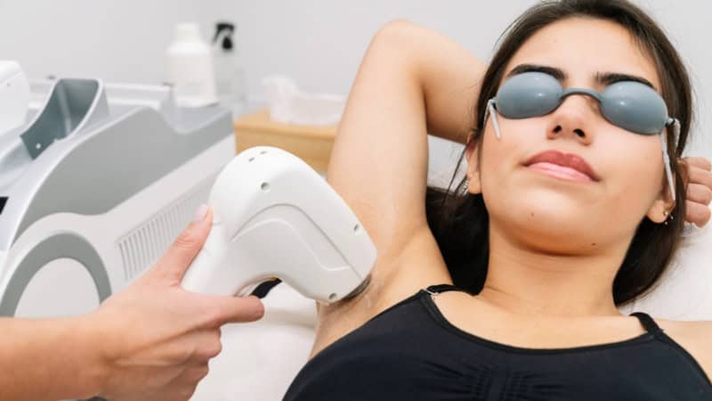 Eine Frau werden mit einem Laser die Achselhaare entfernt.