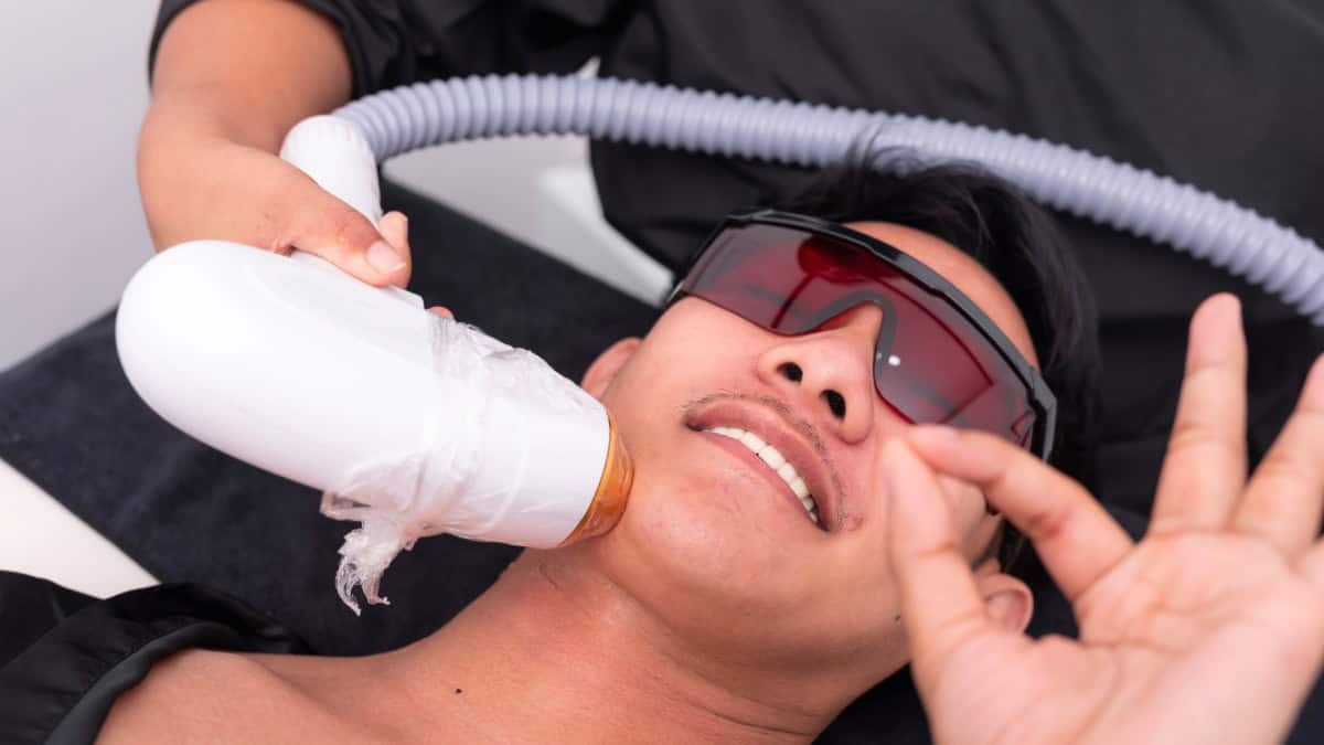 Laser-Haarentfernung für Männer in Berlin