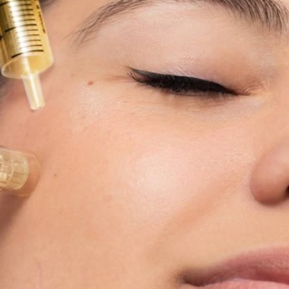 Eine Frau bei der Behandlung mit Hyaluronsäure auf einer Liege.