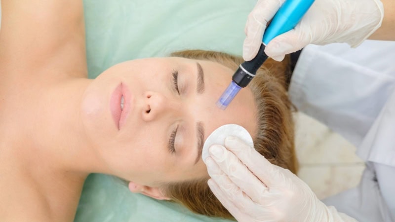 Behandlung zum Lifting ohne Op. Eine Frau liegt auf einer Behandlungsliege.